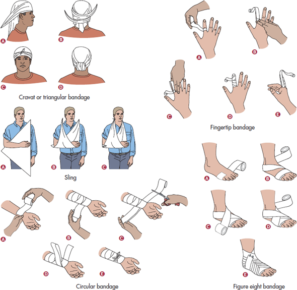 Solved With A Partner Practice Applying Bandages To Each Other 